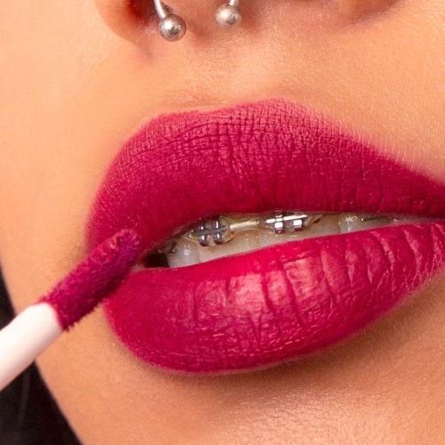 Nära bild av läppar med tandställning, som applicerar rosa läppstift och lip gloss.