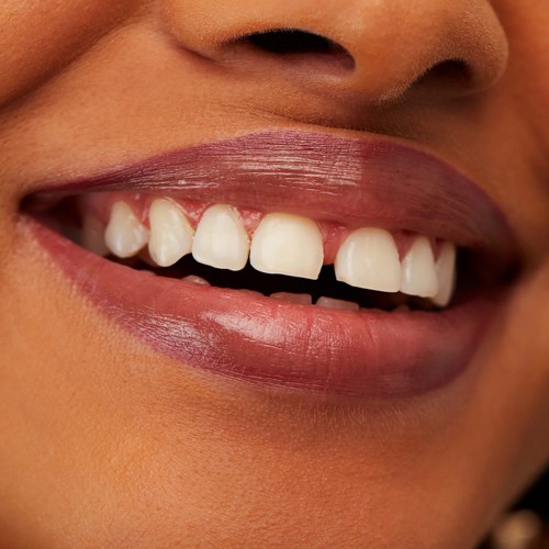 Close-up of a smiling mouth with white teeth and pink lips.
