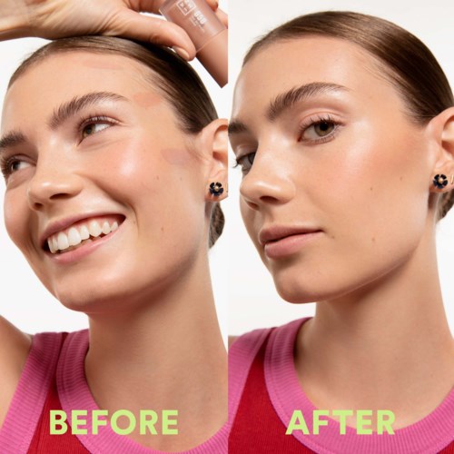 A woman with clear skin, showing a skincare transformation before and after. She wears a pink top and earrings.