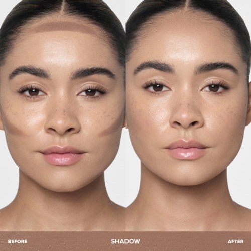 Side-by-side images show skin improvement, fewer spots, and a clearer complexion after treatment.
