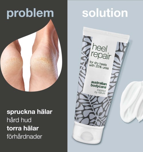 A foot with dry skin next to a tube of heel repair cream for tough skin on dry heels.