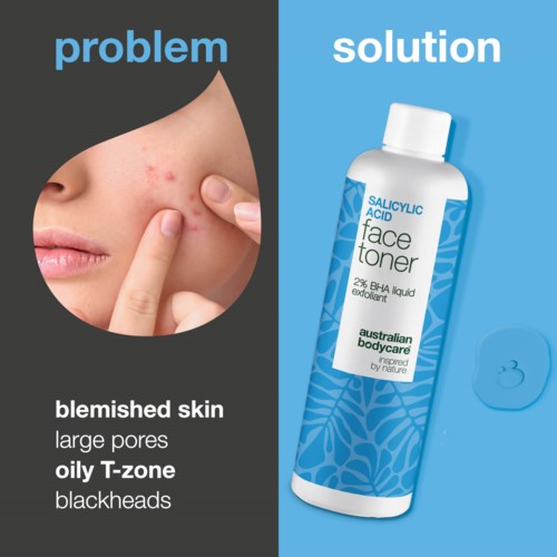 Comparison between skin problems like pimples and a face toner solution for oily skin.