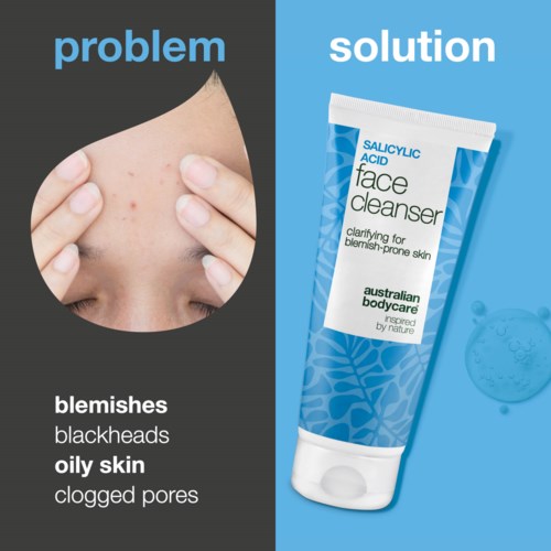 Delt bilde viser hudproblemer som blackheads, fet hud og tette porer på den ene siden, og ansiktsvask for kviser på den andre siden.