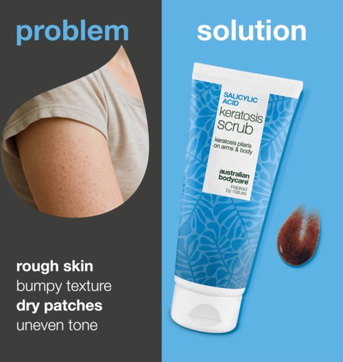 Problem mit rauer Haut, trockenen Stellen und ungleichmäßigem Ton, neben der Keratosis-Scrub Tube.