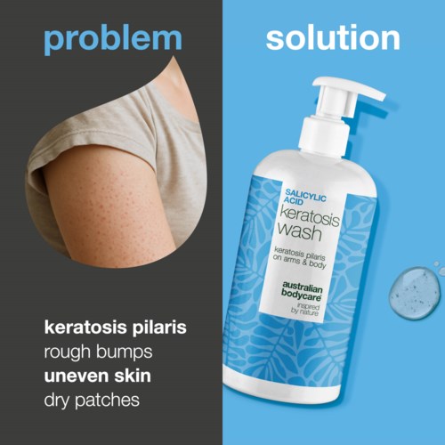 Diagramm vergleicht Hautprobleme mit einer Lösung namens Keratosis pilaris Wasch.
