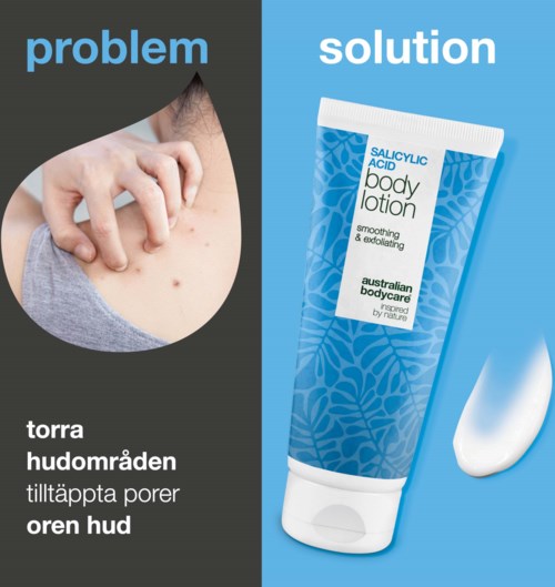 Ein Vergleich zeigt Hautprobleme mit Pickeln und eine Flasche mit Salicylsäure-Körperlotion.