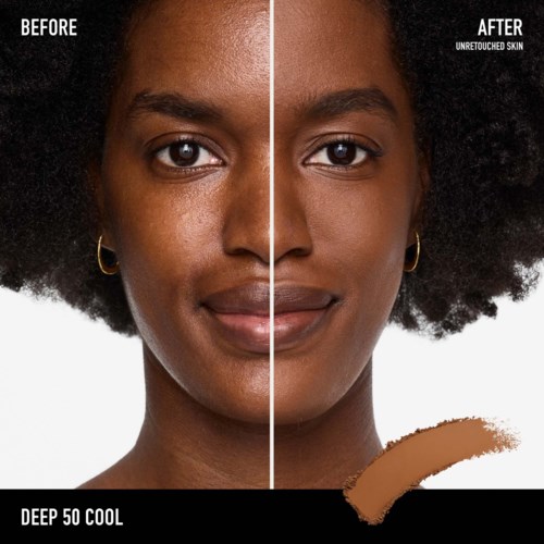 Side-by-side before and after photos showing skin transformation with deep cooling treatment, revealing smoother, lighter skin.