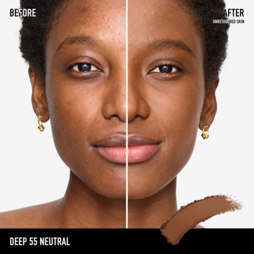 Side-by-side comparison of a woman's face showing before and after skin treatment, with clear skin and even tone.
