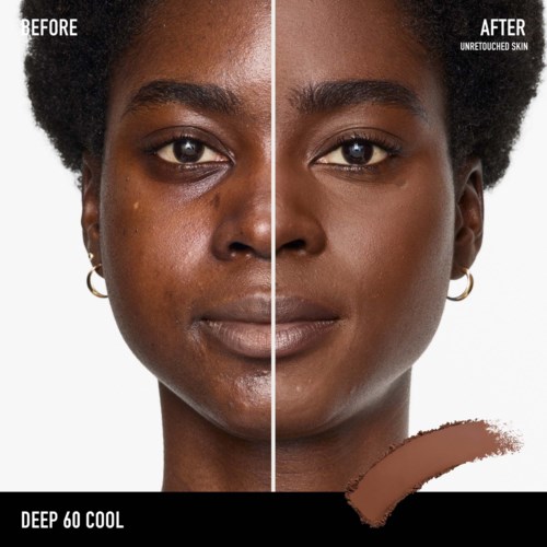A side-by-side comparison of a woman's face before and after skin care, showing clearer, smoother skin after treatment.