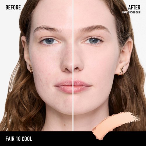A woman with clear skin on one side and acne on the other, showing before and after skincare results.