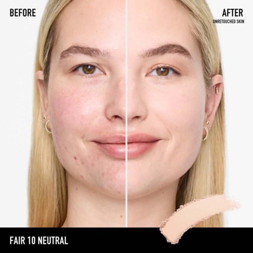 Side-by-side portrait showing before and after skin treatment with clear improvement and smooth skin.