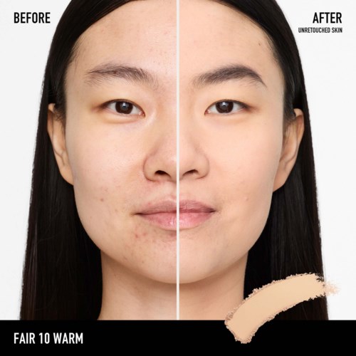 Clear difference in skin, with fewer blemishes and even tone after skincare treatment.