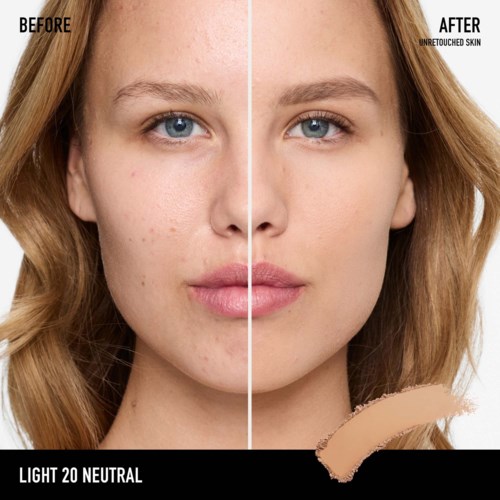 A woman shows clear skin after using a product, with a split image of before and after results.