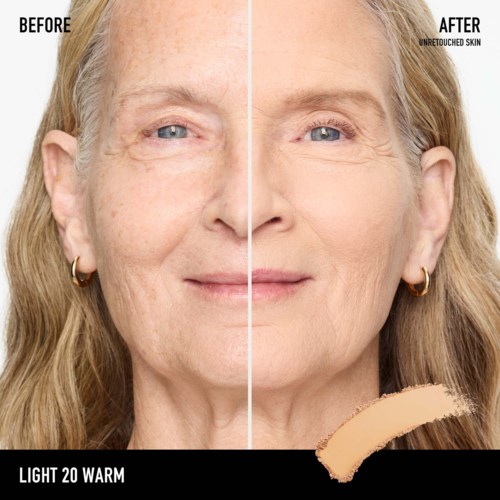 Before and after photos showing reduced wrinkles, even skin tone, and smoother appearance. Label for skin treatment result.