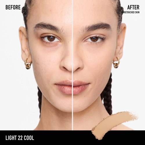 A woman shows her face before and after skin treatment, with clearer skin and even tone in the after photo.