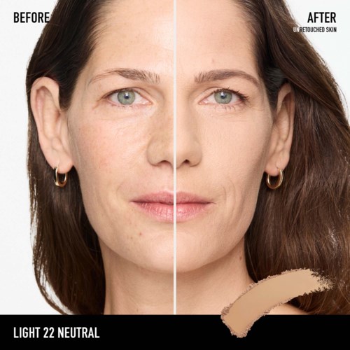 A woman's face shows before and after skin treatment, with clearer skin and even complexion on the right.