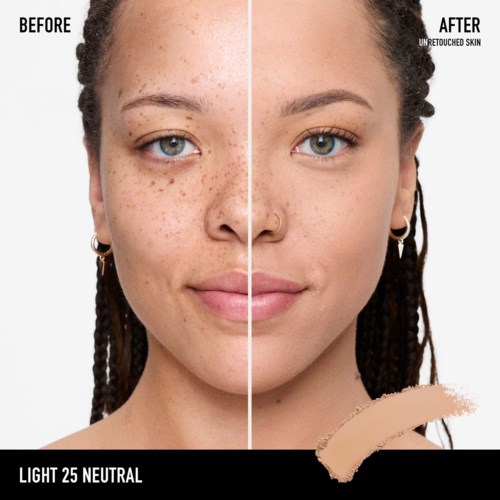 Split face showing before skin with spots and after clear, smooth skin. Labels: before, after, light 25 neutral.