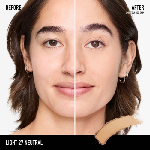Side-by-side comparison showing skin before and after skincare, with clearer, smoother skin on the right.
