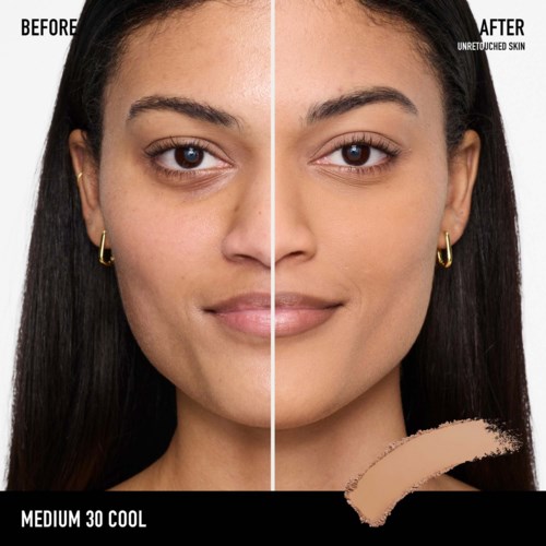 Side-by-side comparison of a woman's face before and after skincare, showing clearer, smoother skin on the right.