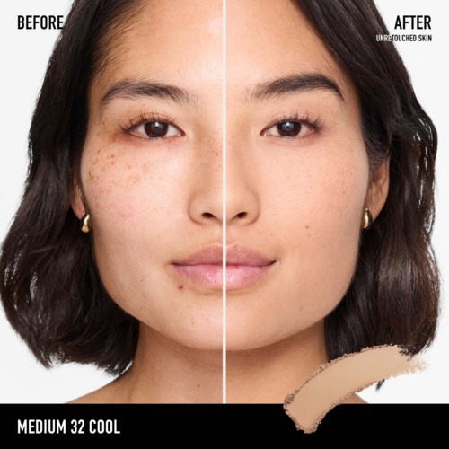A woman with clear, smooth skin shown before and after skincare treatment, skin looks improved and clearer.