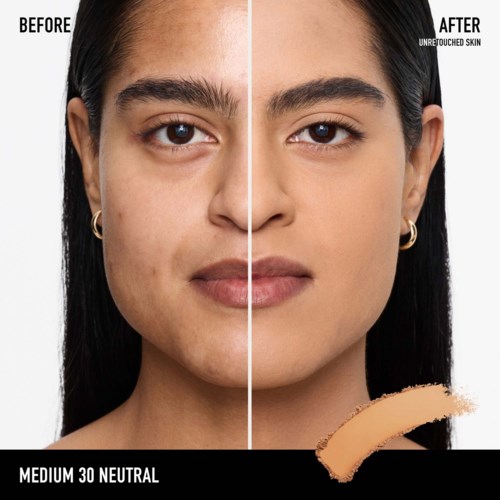 A woman shows a before and after face, with clear skin on the right and skin issues on the left.