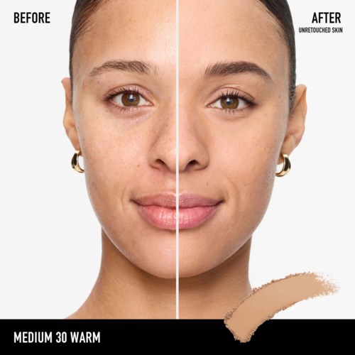 A woman’s face shows before and after skin treatment, with improved, clearer skin and a slight smile.