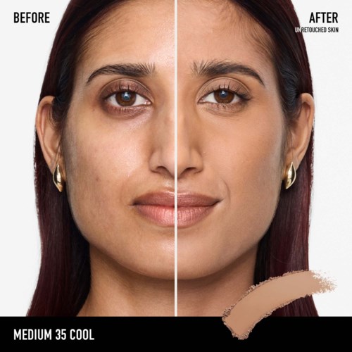 A face before and after skin treatment, showing clearer, smoother, and more even skin tone with improved appearance.