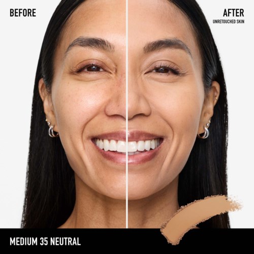 A woman's face shows before and after skin treatment, with clearer skin and a brighter smile in the after photo.