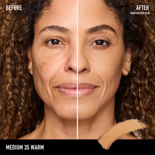 A woman shows clear skin after skincare, with labels 'Before' and 'After' focusing on skin improvements.
