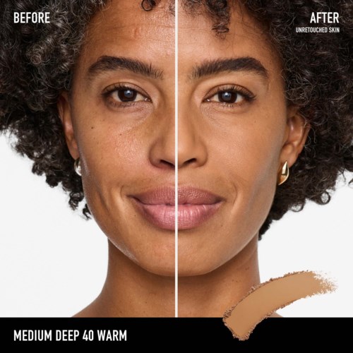 A woman shows face before and after skincare, with clearer skin and a slight smile in the after photo.