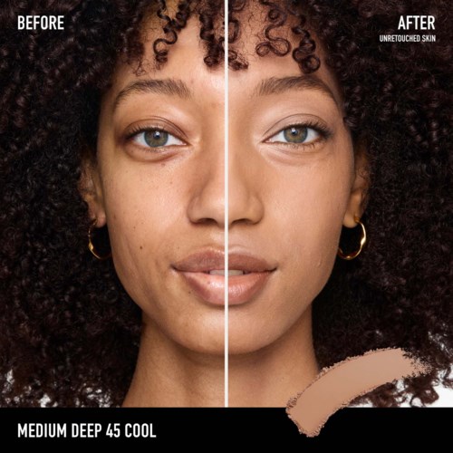 Side-by-side of a woman's face before and after skincare, showing clearer, smoother skin and a slight smile.