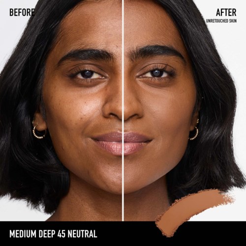Side-by-side comparison of skin before and after treatment, showing clearer, more even skin tone and fewer blemishes.