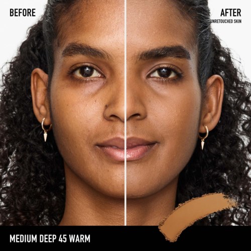 Side-by-side photo showing skin before and after treatment, with smoother, clearer skin on the right.