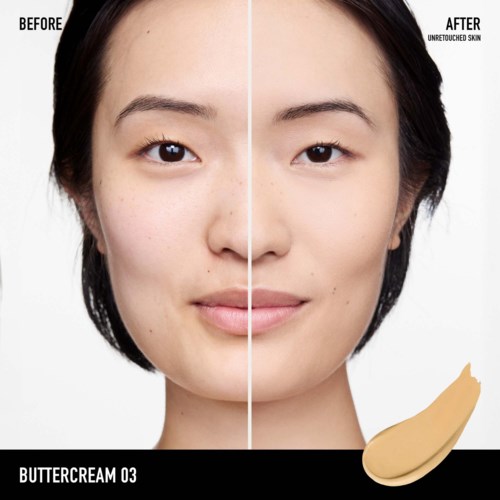 A woman's face is split in half showing before and after skin treatment with clear, smooth skin on the right.