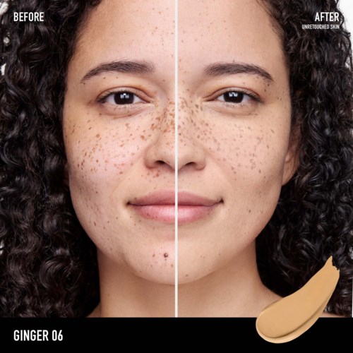 A woman shown before and after using a skincare product, with clearer skin and fewer freckles on the right.