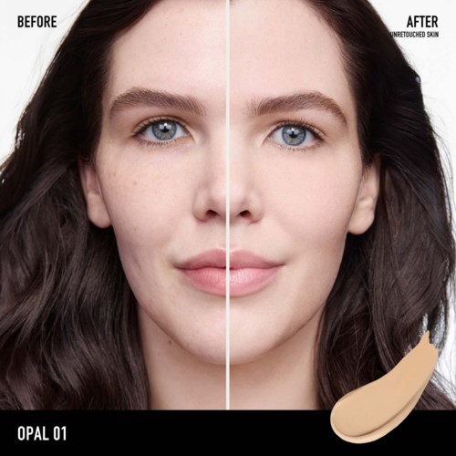 Side-by-side before and after skin improvement showing clearer, smoother face and even skin tone.