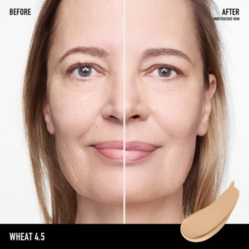 Side-by-side comparison showing a woman's face before and after skin treatment, with smoother, clearer skin on the right.