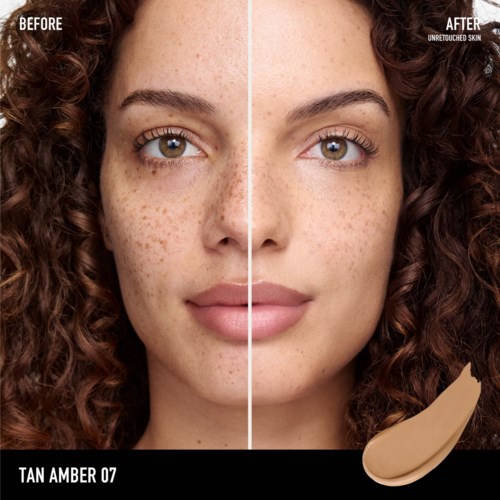 Side-by-side comparison shows before and after skin with fewer freckles and a smoother complexion.