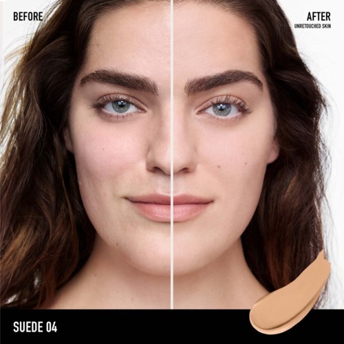 Before and after comparison of skin, showing clearer, smoother, and more even skin tone after treatment.