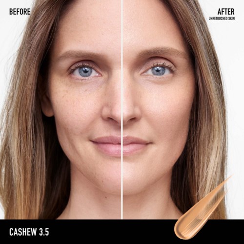 A woman with clear, smooth skin on the right and freckled, uneven skin on the left before and after skincare.