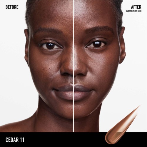 A woman's face divided into before and after skincare, showing clear improvement on the right side.