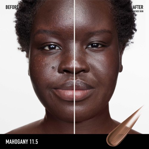 A face split into before and after skin treatment, showing clear skin on the right side, dark spots on the left.