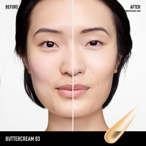 Clear skin with fewer pimples and darker spots after using Buttercream 03 skincare product.