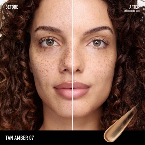 One side shows freckles and uneven skin, the other shows clear, smooth skin after treatment.