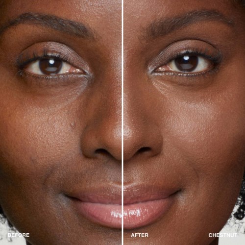 A woman's face showing improved skin and a brighter, more even tone after skin treatment.