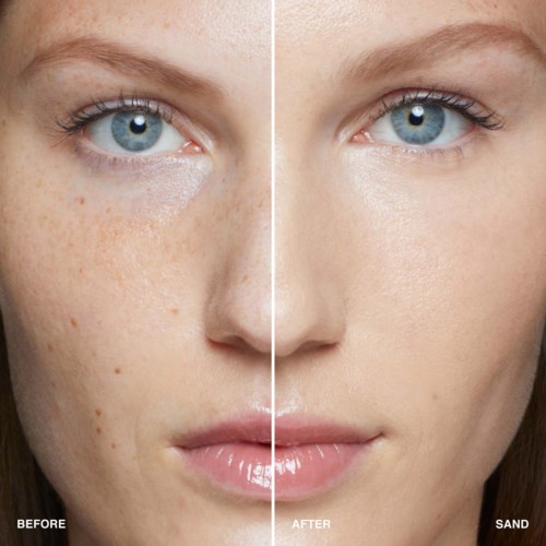 A face shows clear skin with fewer spots on one side and more freckles on the other.