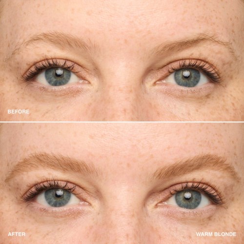 Close-up of eyes showing before and after skin improvement, with a focus on skin tone and texture. No makeup.
