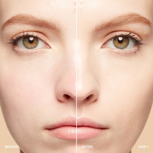 Side-by-side images show a face before and after skin treatment, with clearer skin and reduced blemishes.