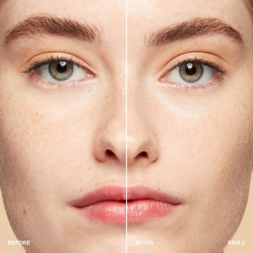 A woman's face shows before and after images highlighting skin improvement and clearer complexion.