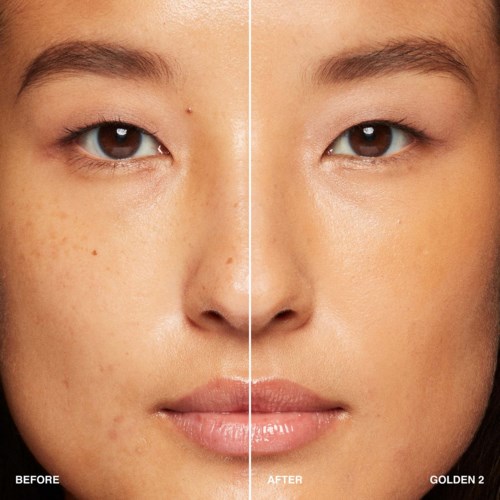 Before and after comparison of skin, showing clear improvement and fewer spots.